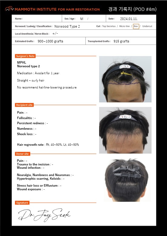 Apgujeong Mammoth Hairline Hair Transplantation Review in the 4th Month