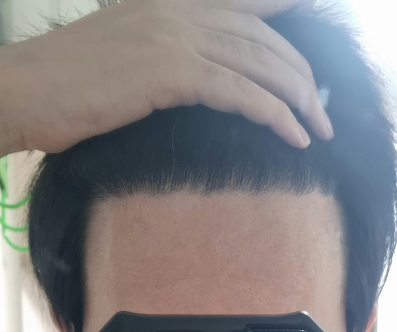 Mo Plus) It's been 7 months