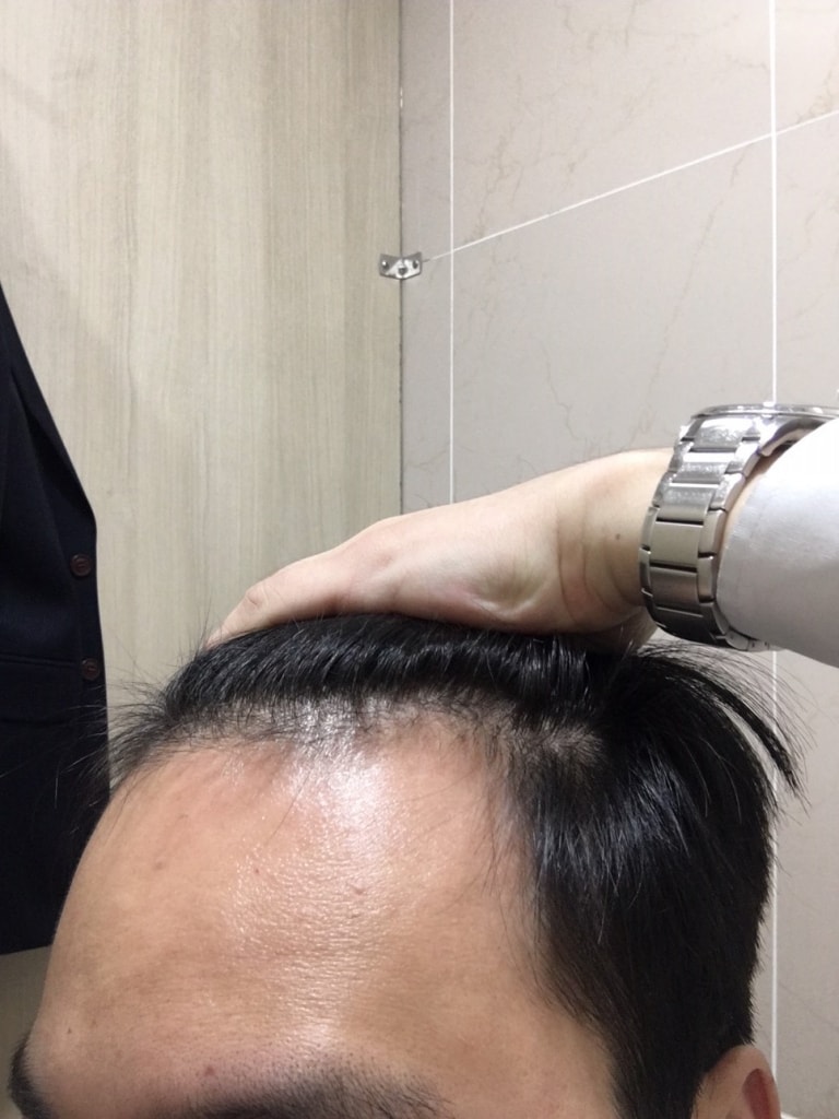 수술전1.JPG