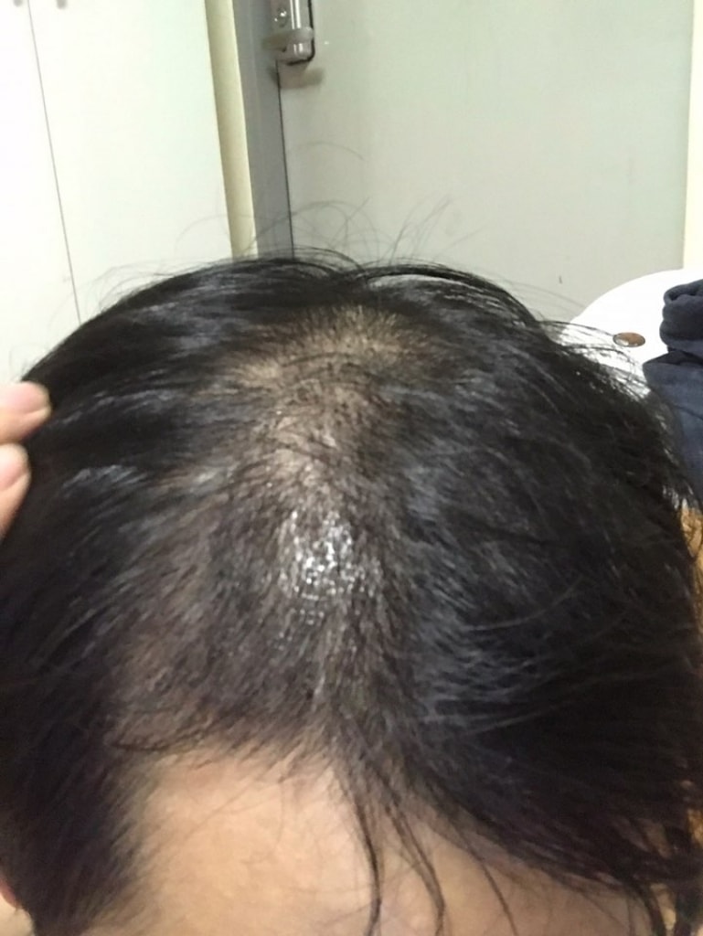 KakaoTalk_20170625_155234282.jpg