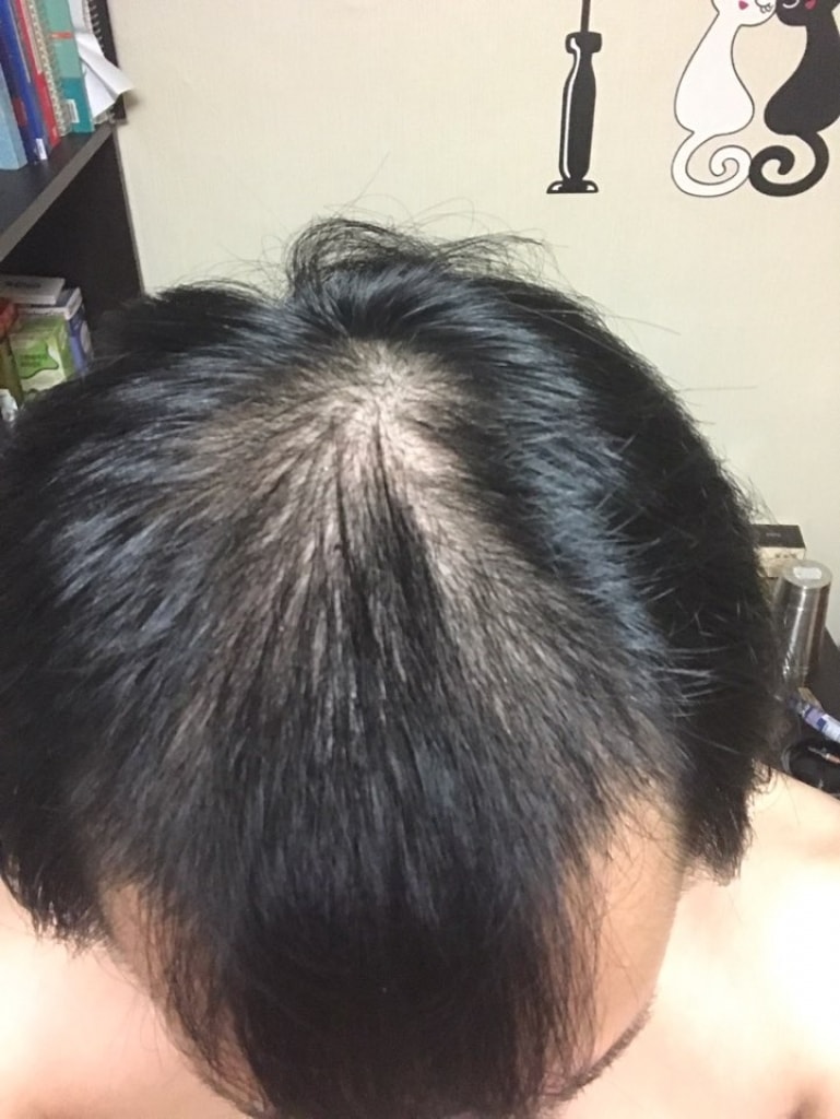 KakaoTalk_20170625_155235596.jpg