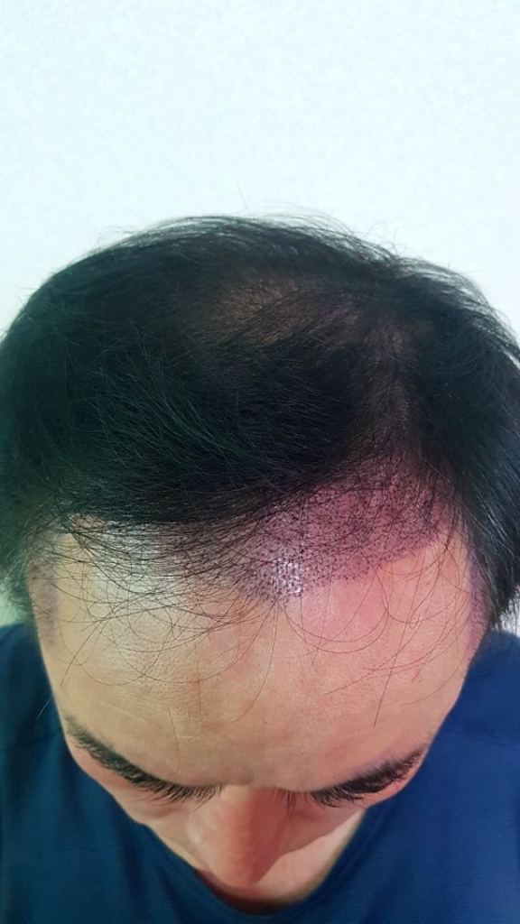 20180309 (2).jpg