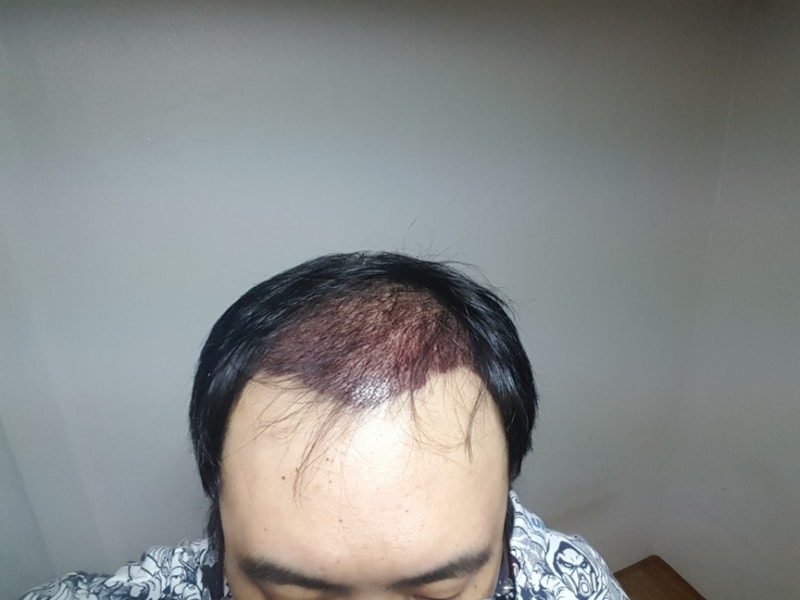 KakaoTalk_20180315_165248904.jpg