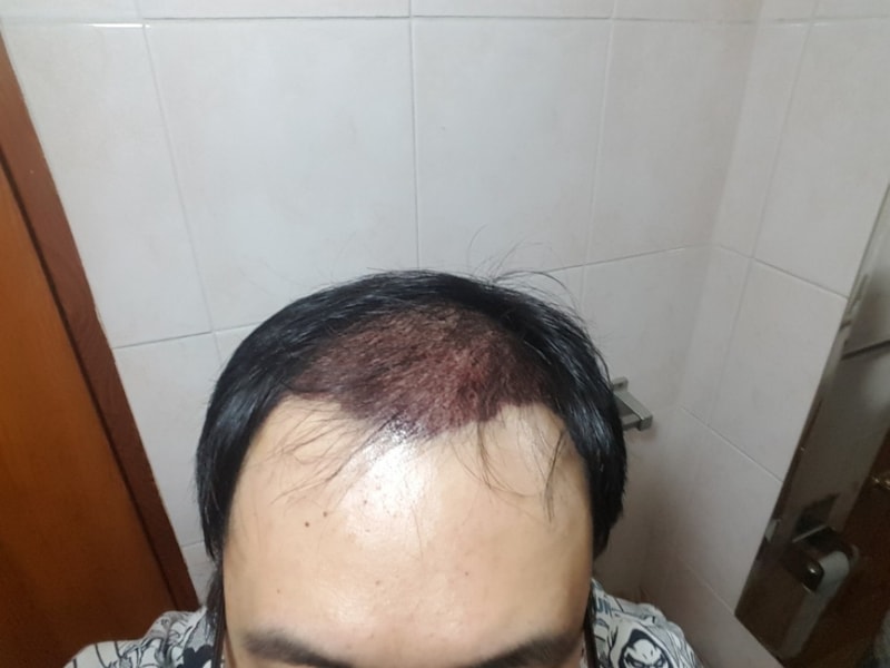 KakaoTalk_20180315_164343749.jpg
