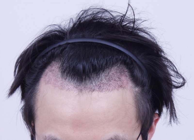 1개월.JPG