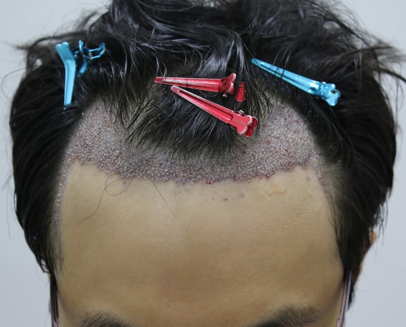 후1.JPG
