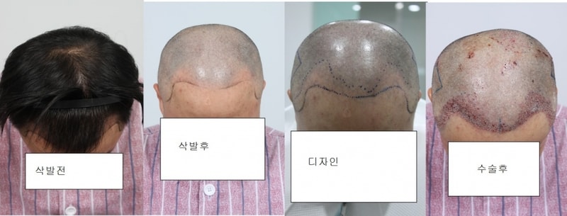 1.JPG