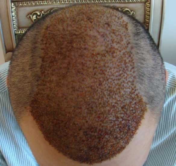 31.jpg