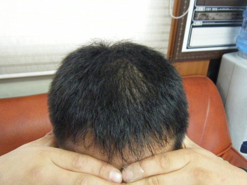 정면.JPG