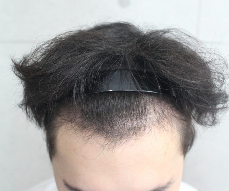 KakaoTalk_20190807_190357644 (4개월).jpg