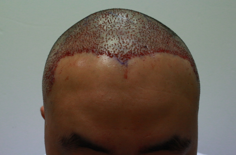 20150119_101318.png