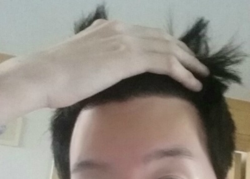 수술후2.jpg