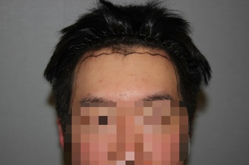 수술전전.jpg