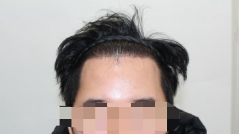 수술후.jpg