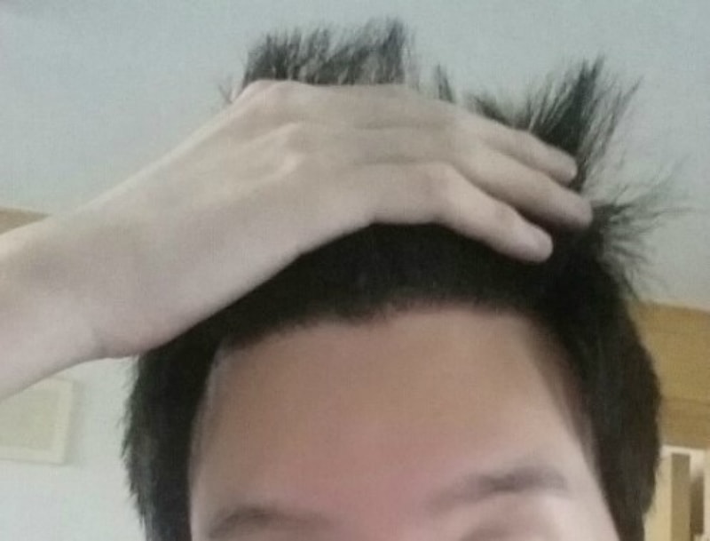 수술후1.jpg