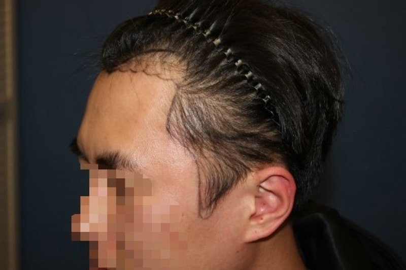 수술전2.jpg