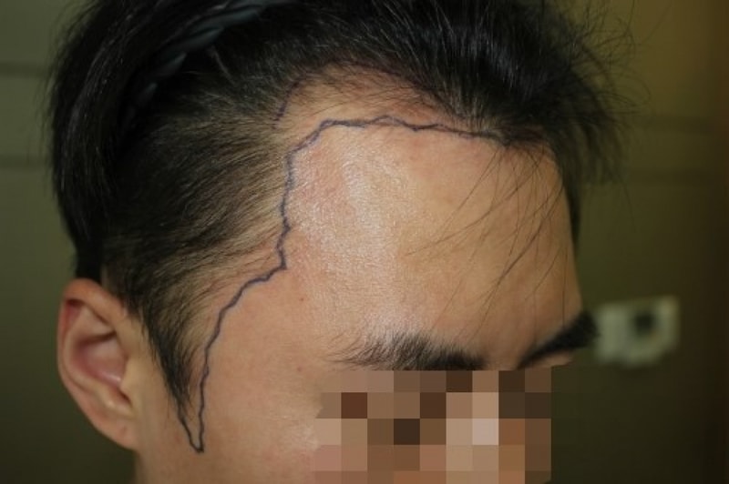 수술전에사진1.jpg