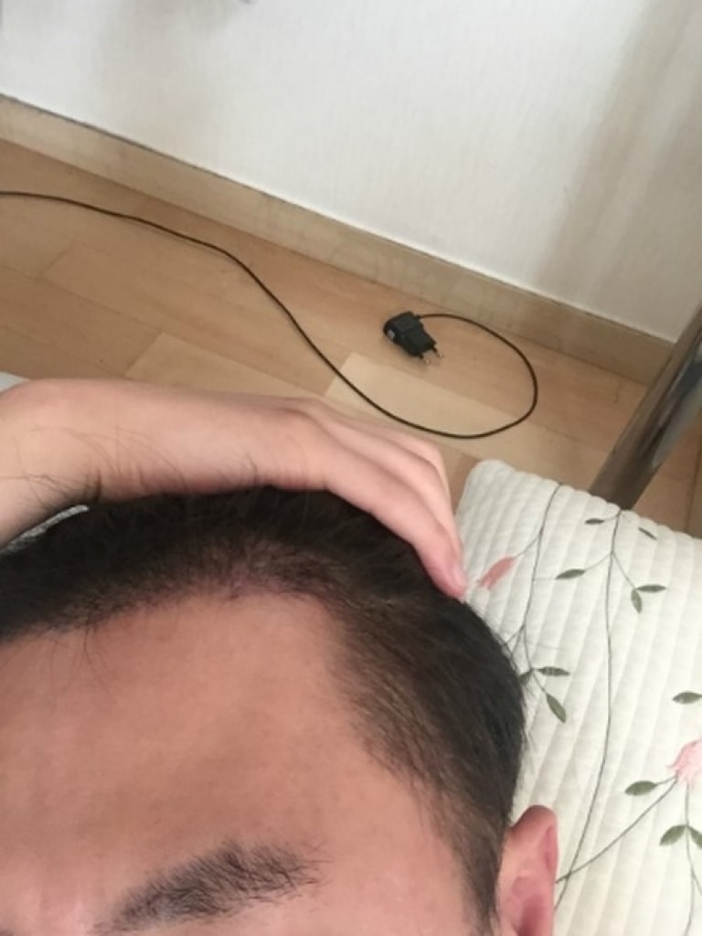 수술후에사진2.jpg