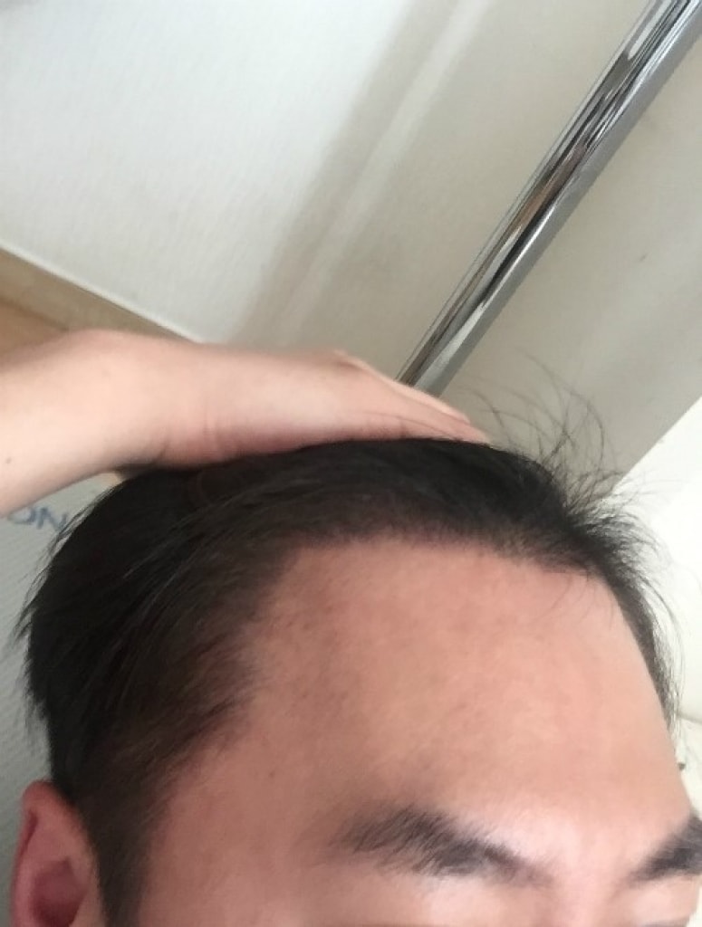수술후에사진1.jpg