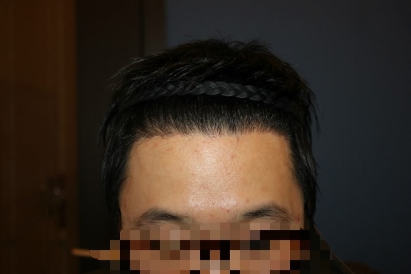 수술후2.jpg