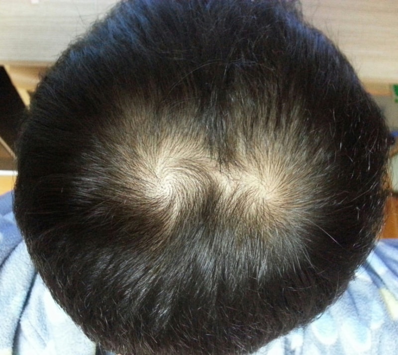 수술후309일2.jpg