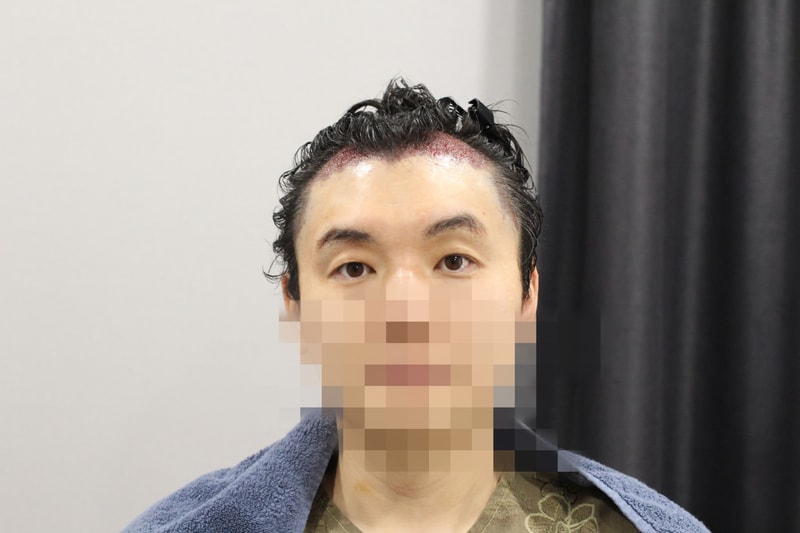 수술직후-1.jpg