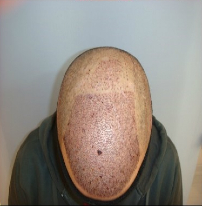 5.PNG