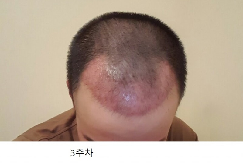이주일후.jpg