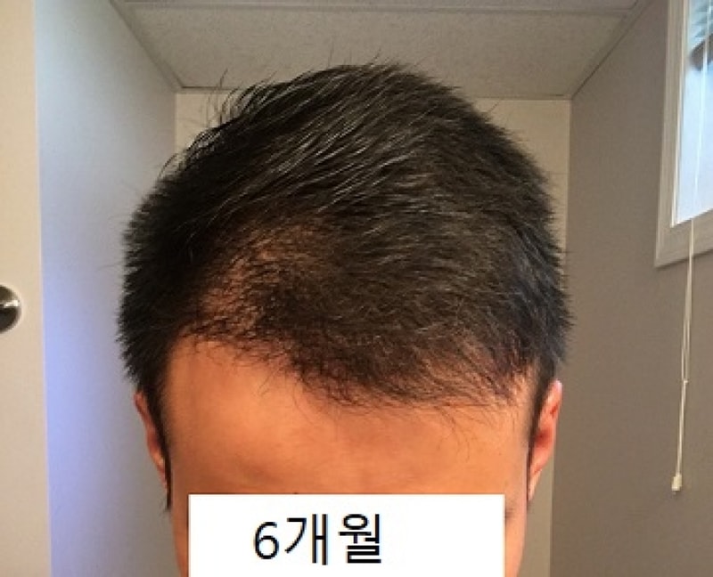 6개월.jpg