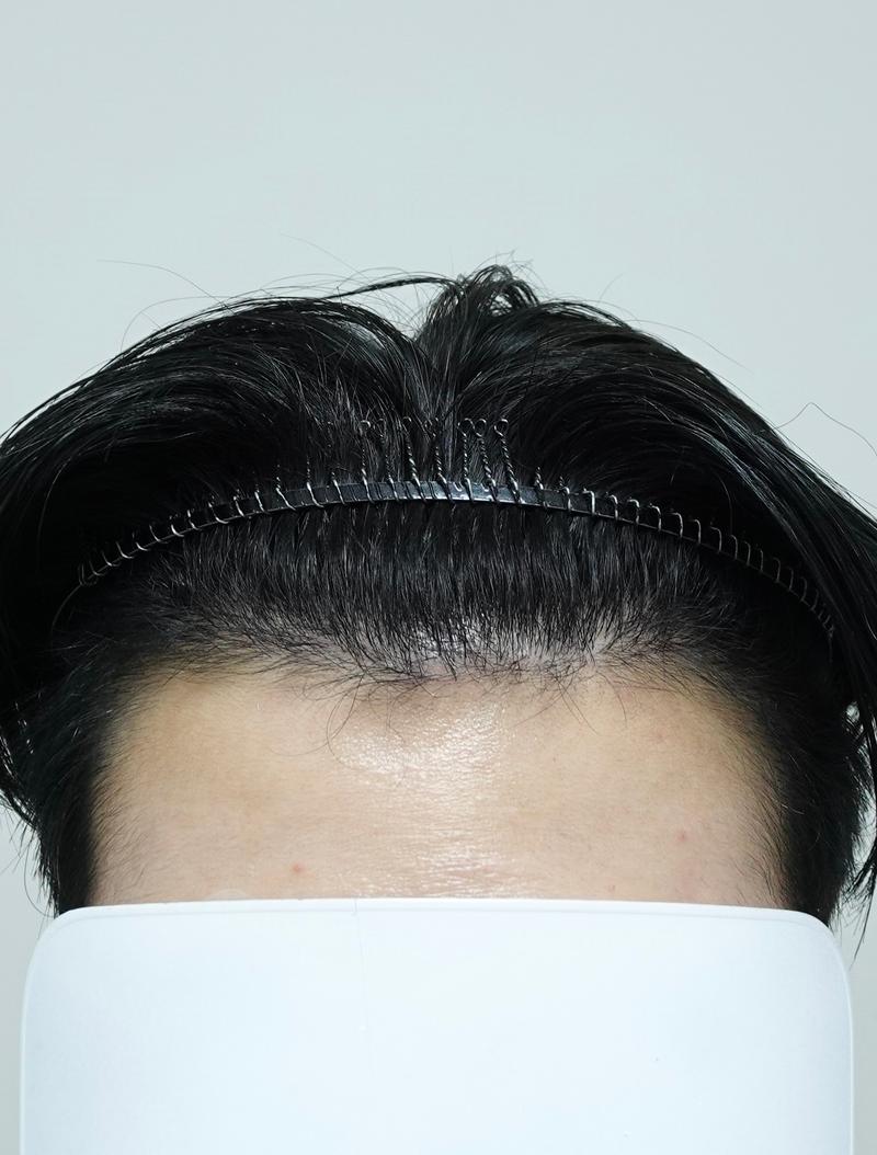 5개월 경과