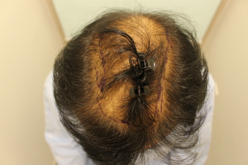 포토후기 이미지