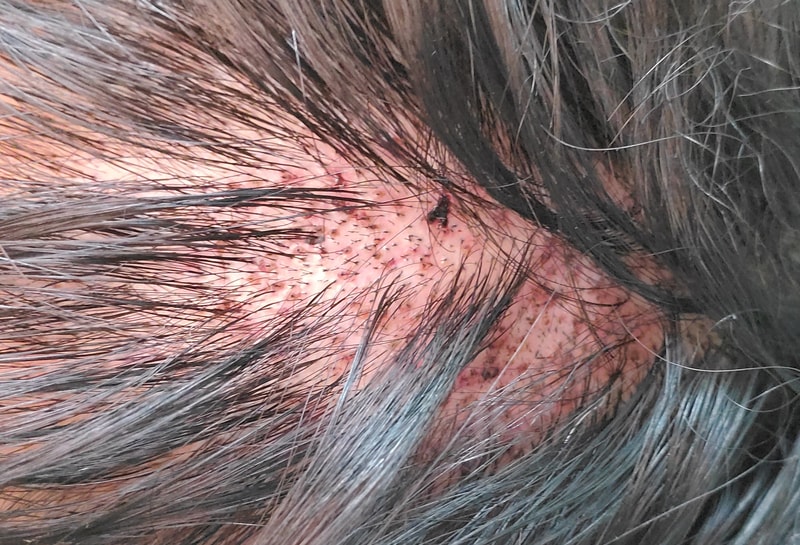 Front after 4 days.jpg