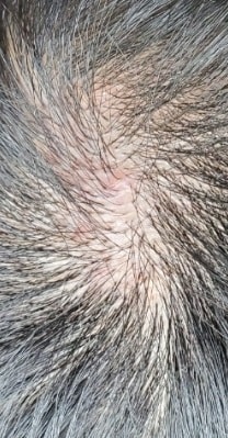 Before surgery back.jpg