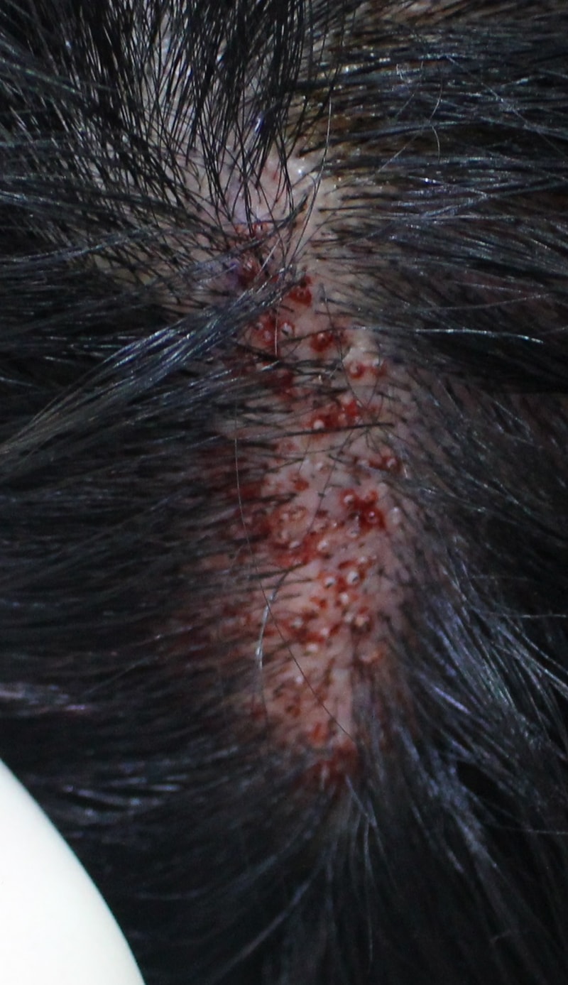 Scar.jpg
