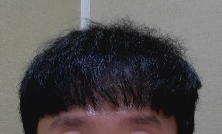 Before surgery.jpg