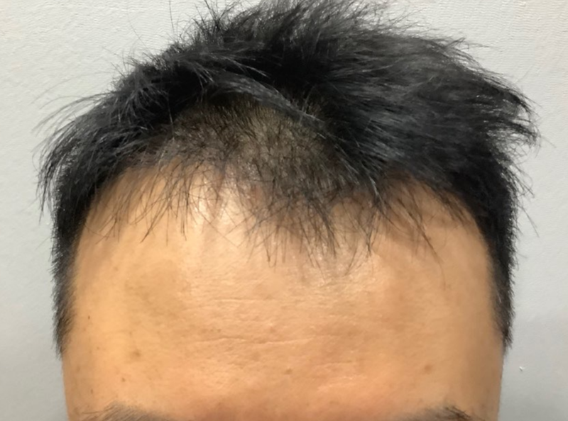 before.PNG
