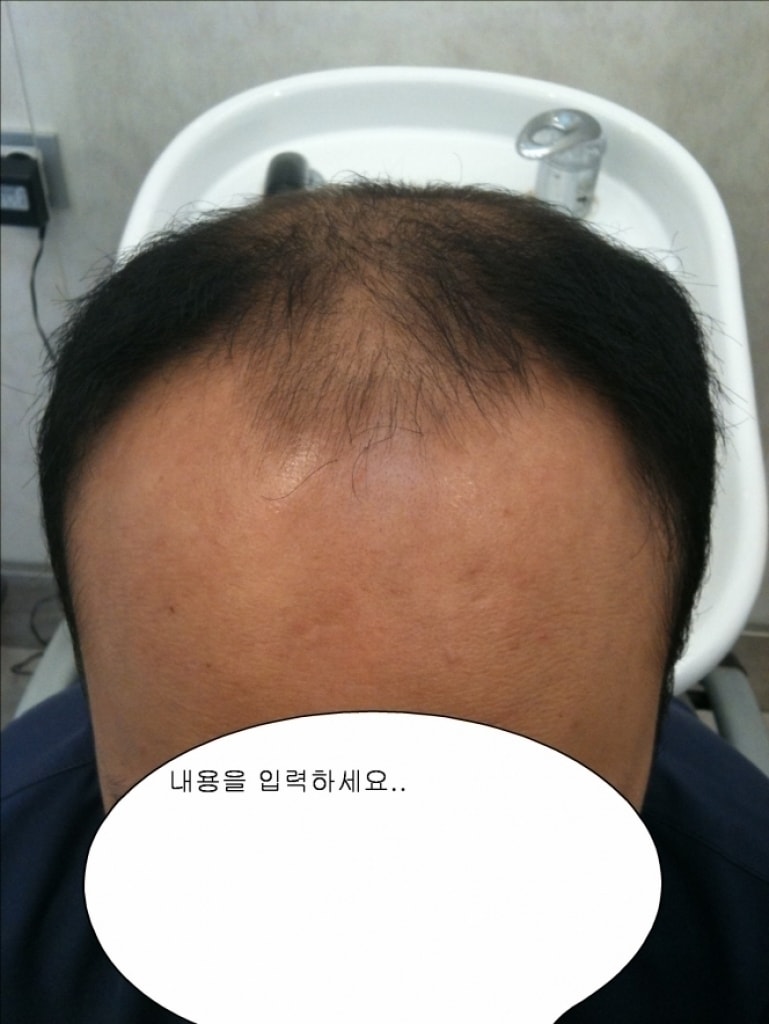 크기변환_정면1.jpg