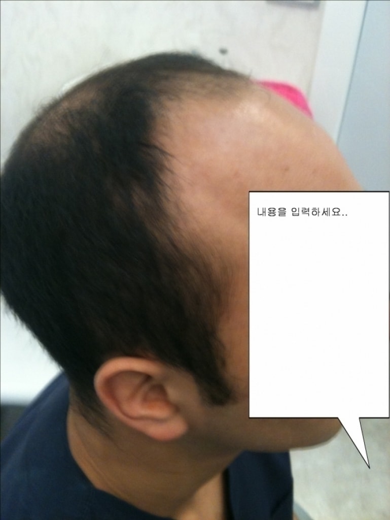 크기변환_우측면.jpg