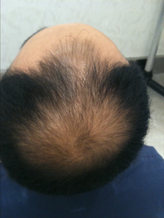크기변환_정수리1.jpg