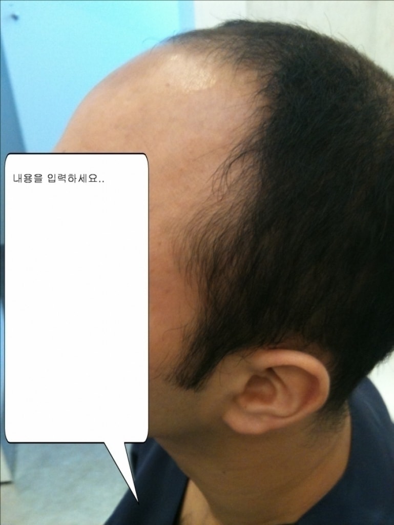 크기변환_좌측면.jpg