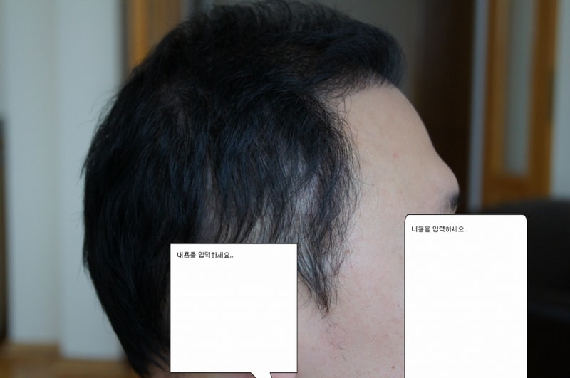 3 6개월 후.jpg