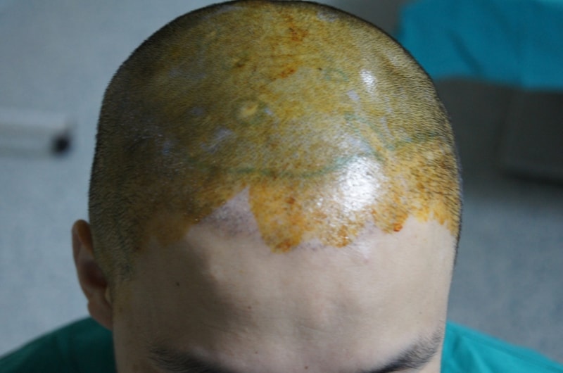 정현이1.jpg