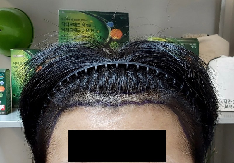 전 정면3.jpg
