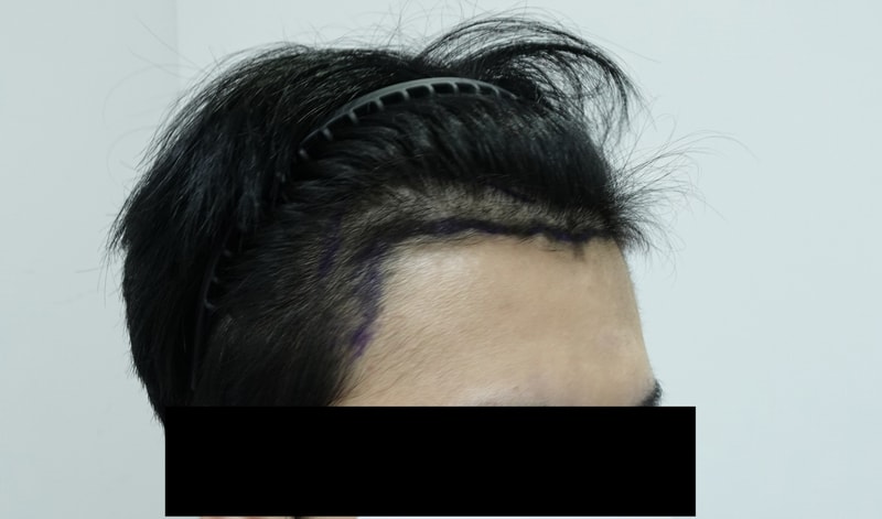 전 오른.jpg