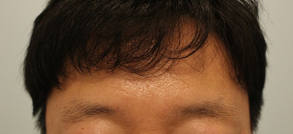 수술전 2.JPG
