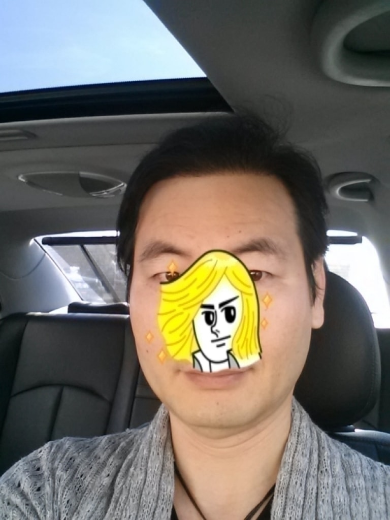 20131011_수술후11개월2.jpg