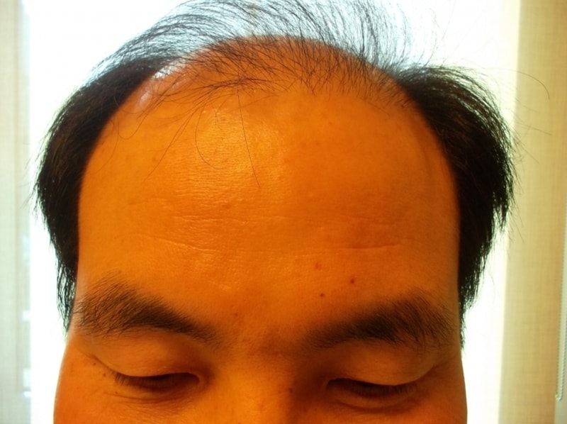 수술전사진1.JPG