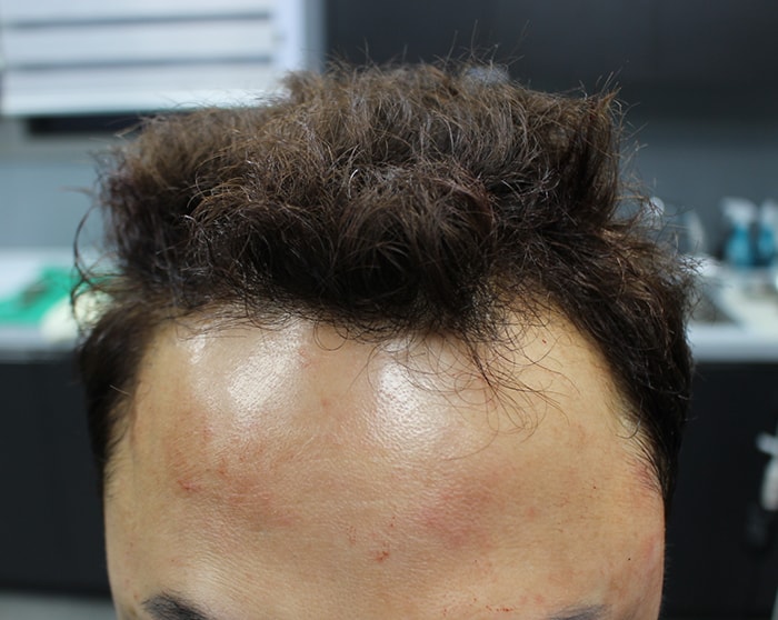 수술전 디자인 2.JPG
