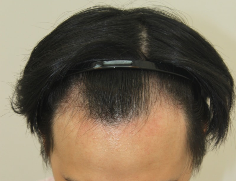 Change in progress up to 7 months