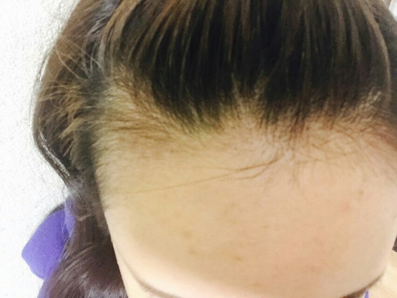 포헤어 암흑기 지나가고 있어요